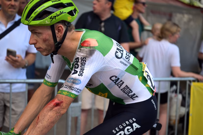 Dutch Alex Molenaar of Caja Rural-Seguros RGA is bruised after a fall at stage 5 of the 2026 Tour de France cycling race, a stage of 158km from Lannemezan to Pau, on Wednesday 08 July 2026. The 113th edition of the Tour de France starts on Saturday 4 July in Barcelona, Spain, and will finish in Paris, France on the 26th of July. BELGA PHOTO DAVID PINTENS